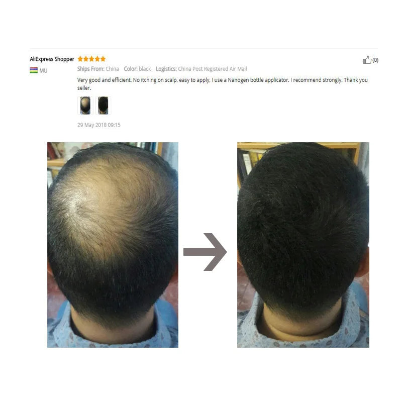 Hair Fiber & Regrowth Powder — Keratin Density Builder, Multiple Shades