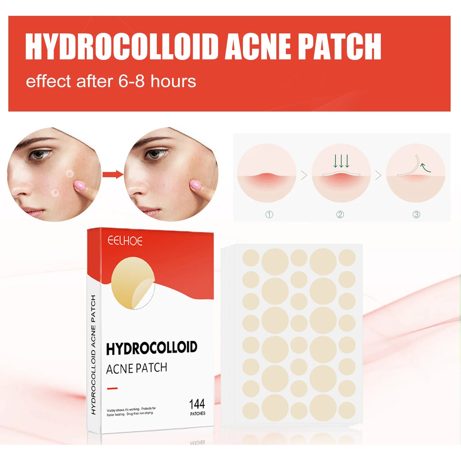 Hydrocolloid Acne Patches — 144 Pack, Ultra-Thin Overnight Treatment