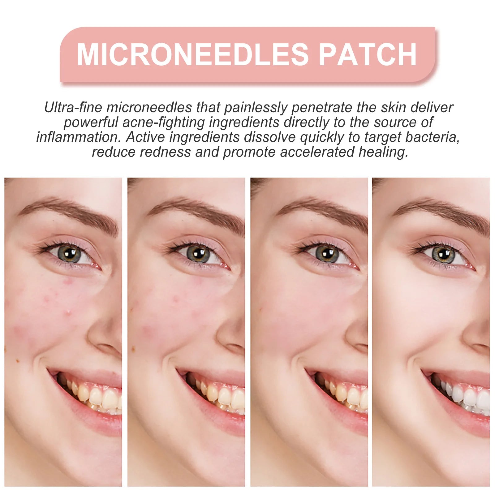 Hydrocolloid Face Patches for Pimples — Targeted Blemish Treatment