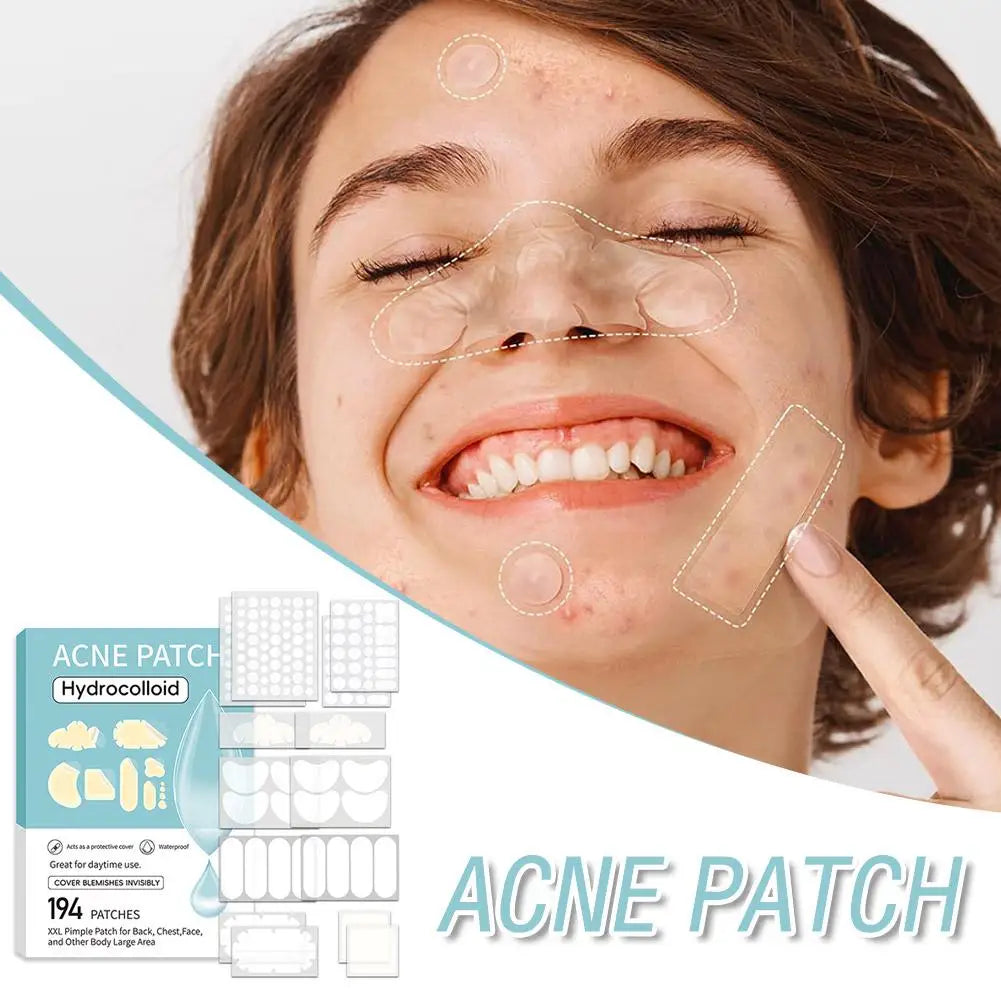 Large-Capacity Pimple Patch Set — Multi-Size Hydrocolloid Value Pack