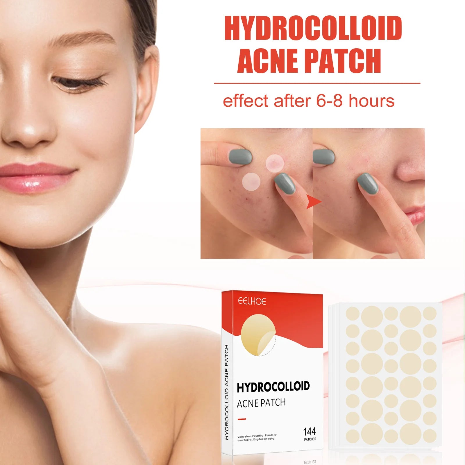 Hydrocolloid Acne Patches — 144 Pack, Ultra-Thin Overnight Treatment
