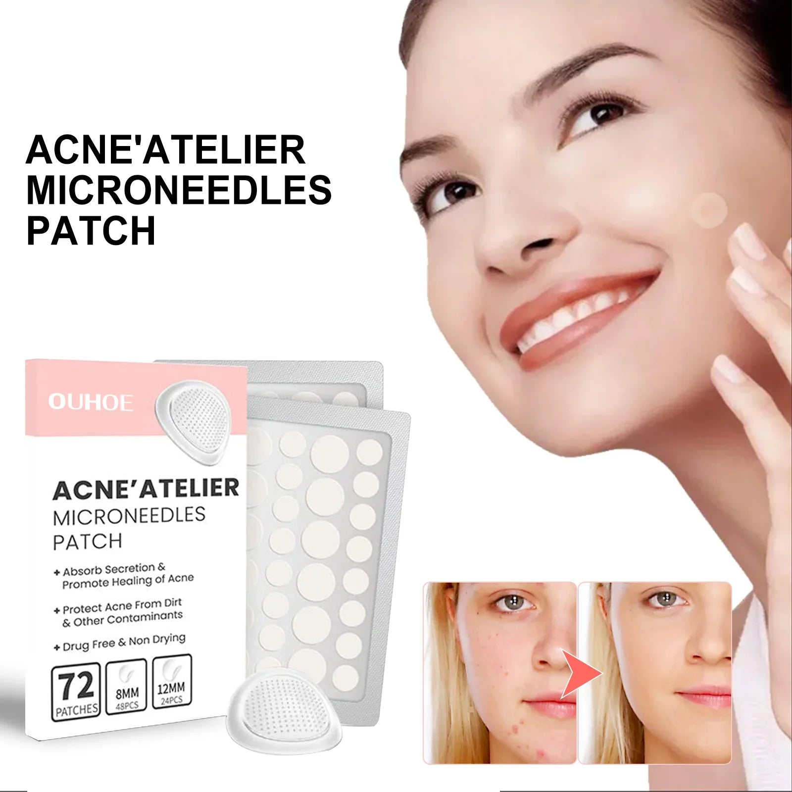 Hydrocolloid Face Patches for Pimples — Targeted Blemish Treatment