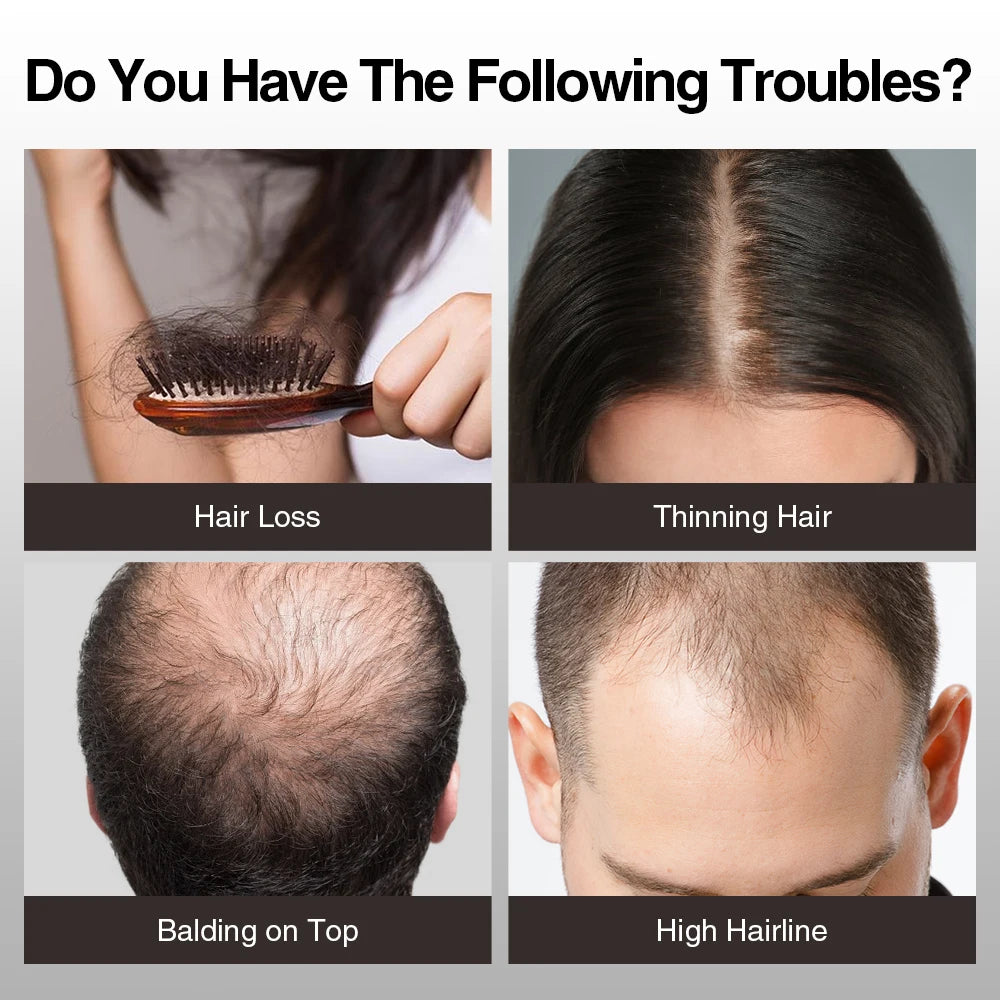 Ms.Dear Hair Fiber Powder — Keratin Density Builder