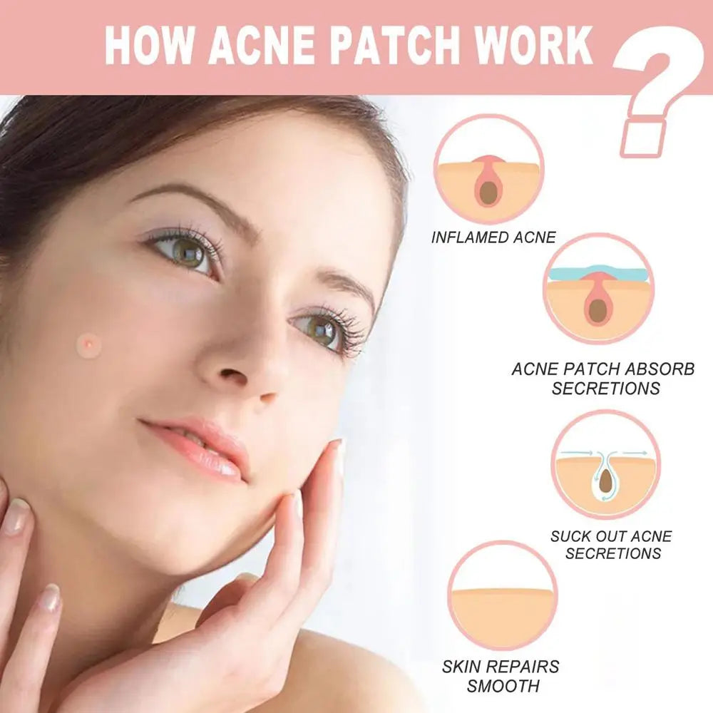 Invisible Hydrocolloid Pimple Patches — Overnight Blemish Treatment