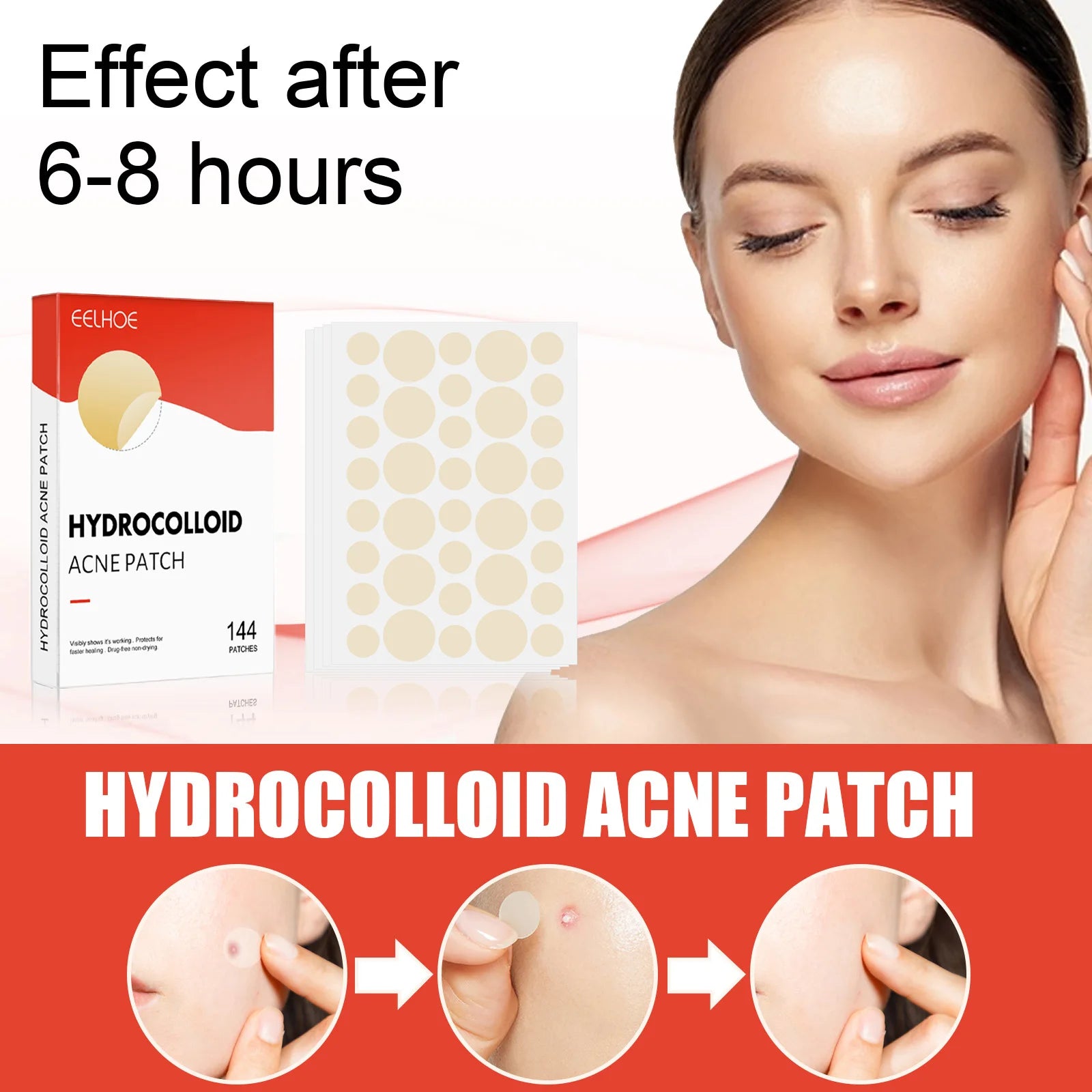 Hydrocolloid Acne Patches — 144 Pack, Ultra-Thin Overnight Treatment