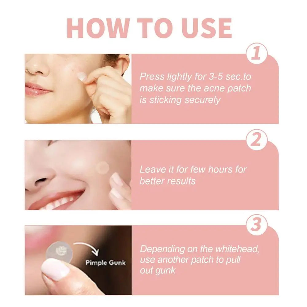 Invisible Hydrocolloid Pimple Patches — Overnight Blemish Treatment