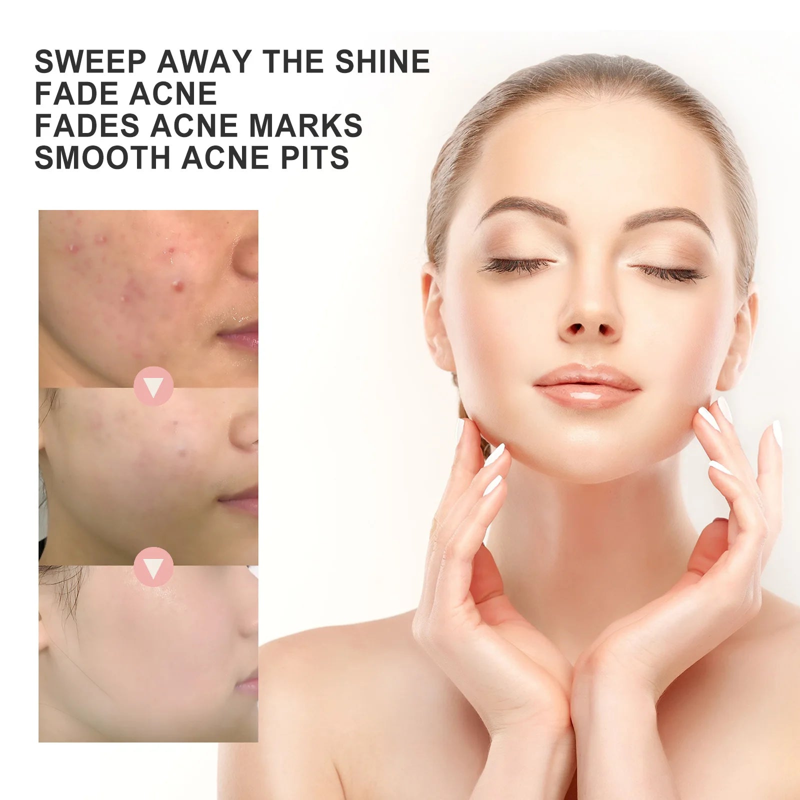 Hydrocolloid Face Patches for Pimples — Targeted Blemish Treatment