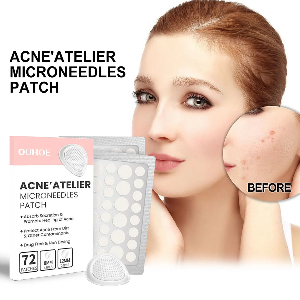 Hydrocolloid Face Patches for Pimples — Targeted Blemish Treatment