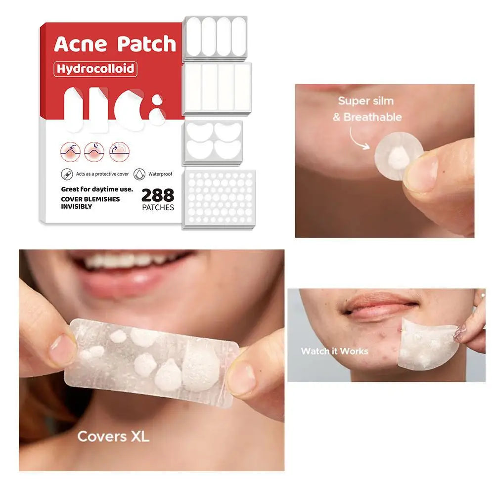 Large-Capacity Pimple Patch Set — Multi-Size Hydrocolloid Value Pack