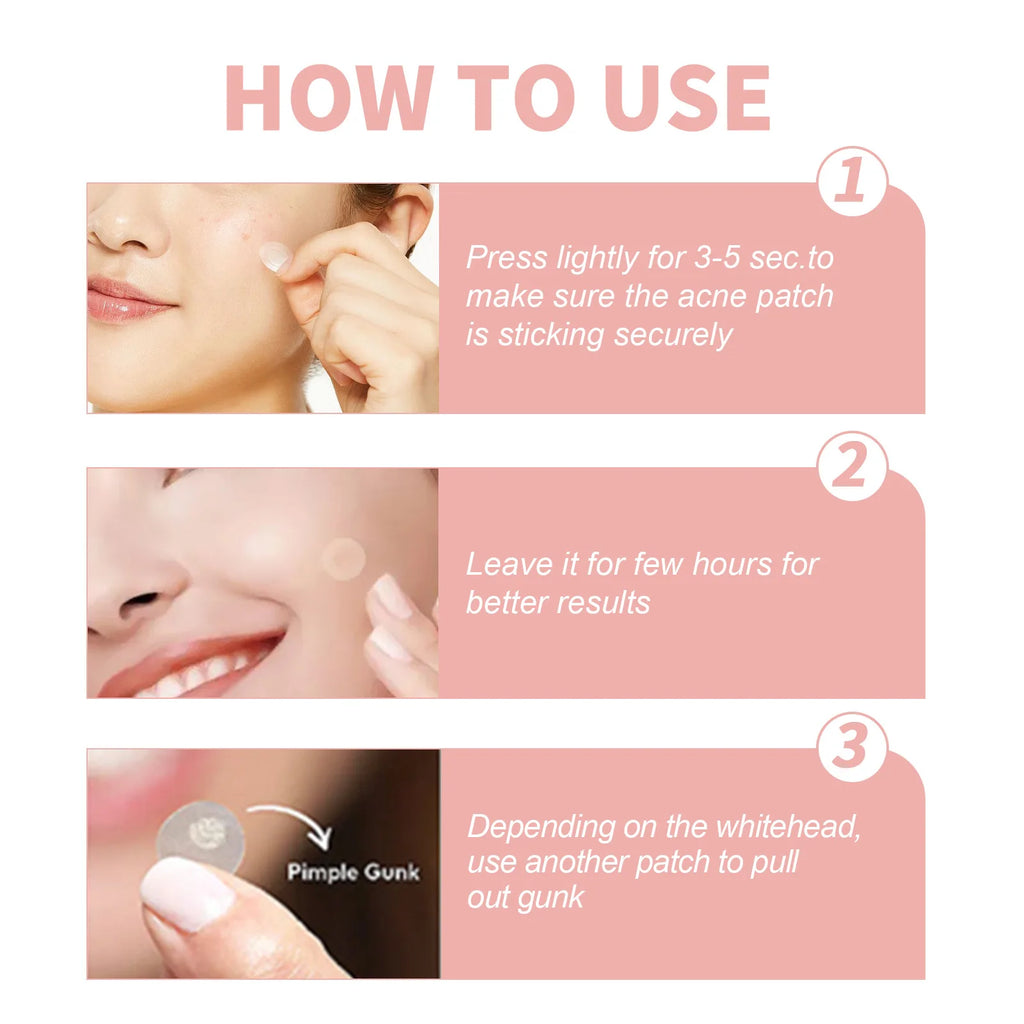 Hydrocolloid Face Patches for Pimples — Targeted Blemish Treatment