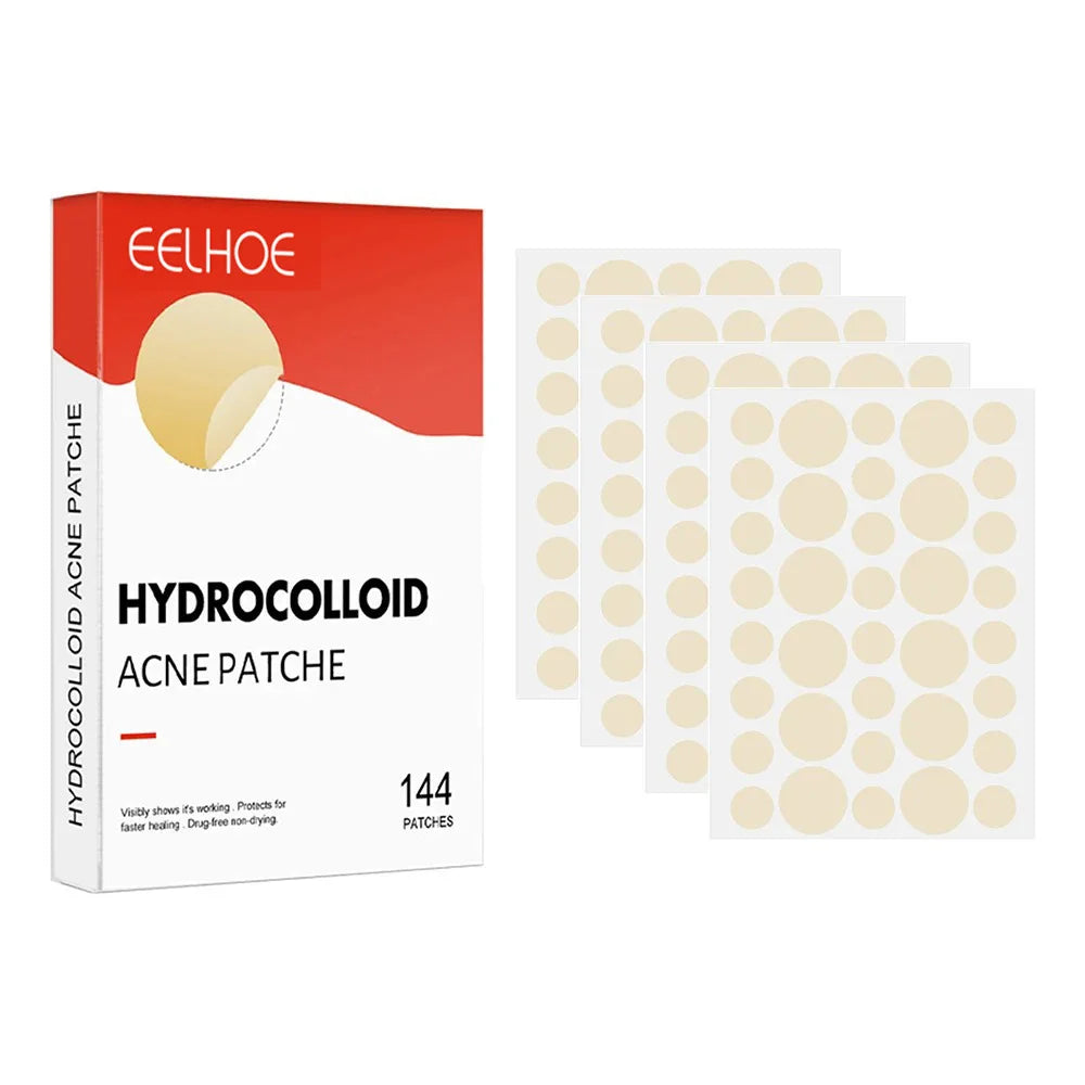 Hydrocolloid Acne Patches — 144 Pack, Ultra-Thin Overnight Treatment
