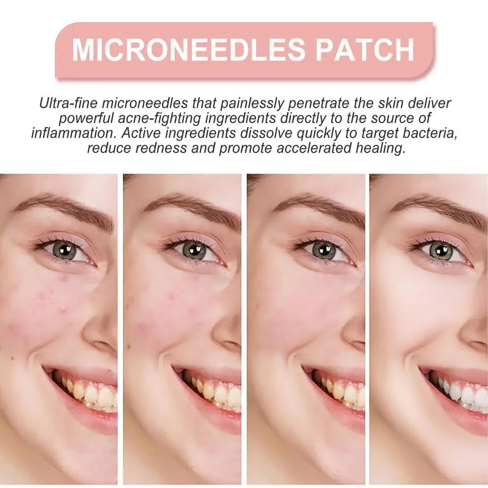Invisible Hydrocolloid Pimple Patches — Overnight Blemish Treatment