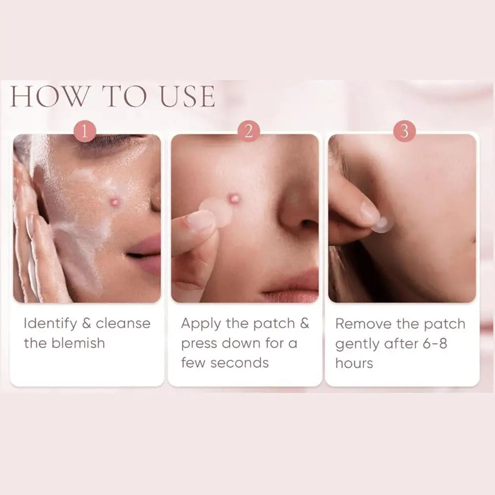 Large-Capacity Pimple Patch Set — Multi-Size Hydrocolloid Value Pack