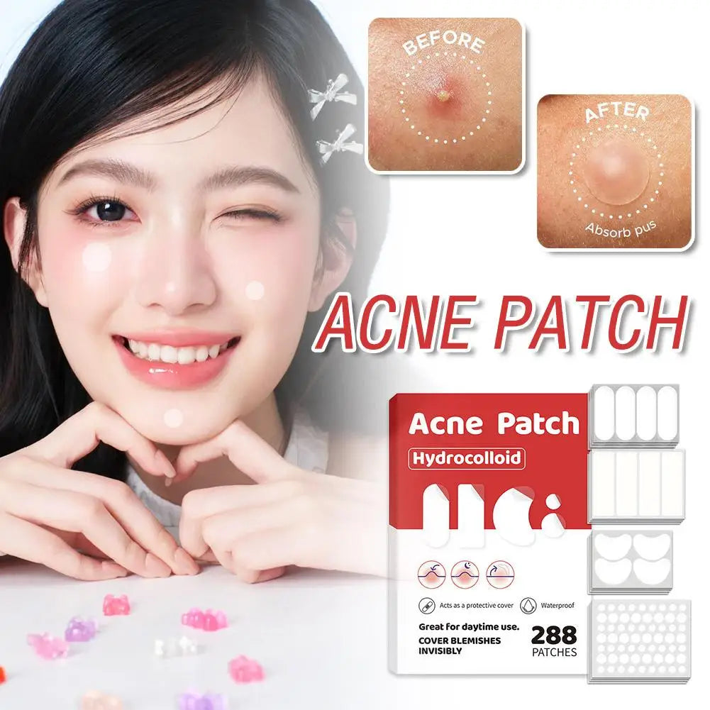 Large-Capacity Pimple Patch Set — Multi-Size Hydrocolloid Value Pack
