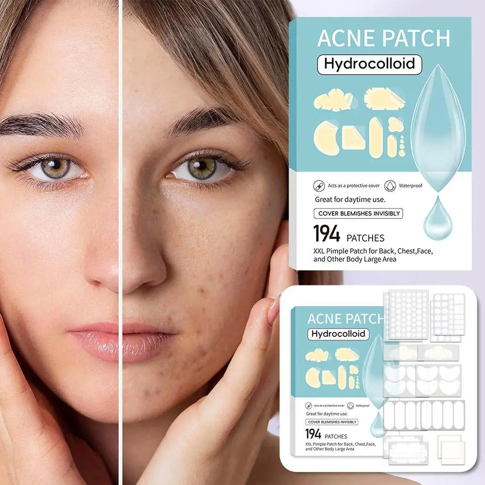 Large-Capacity Pimple Patch Set — Multi-Size Hydrocolloid Value Pack