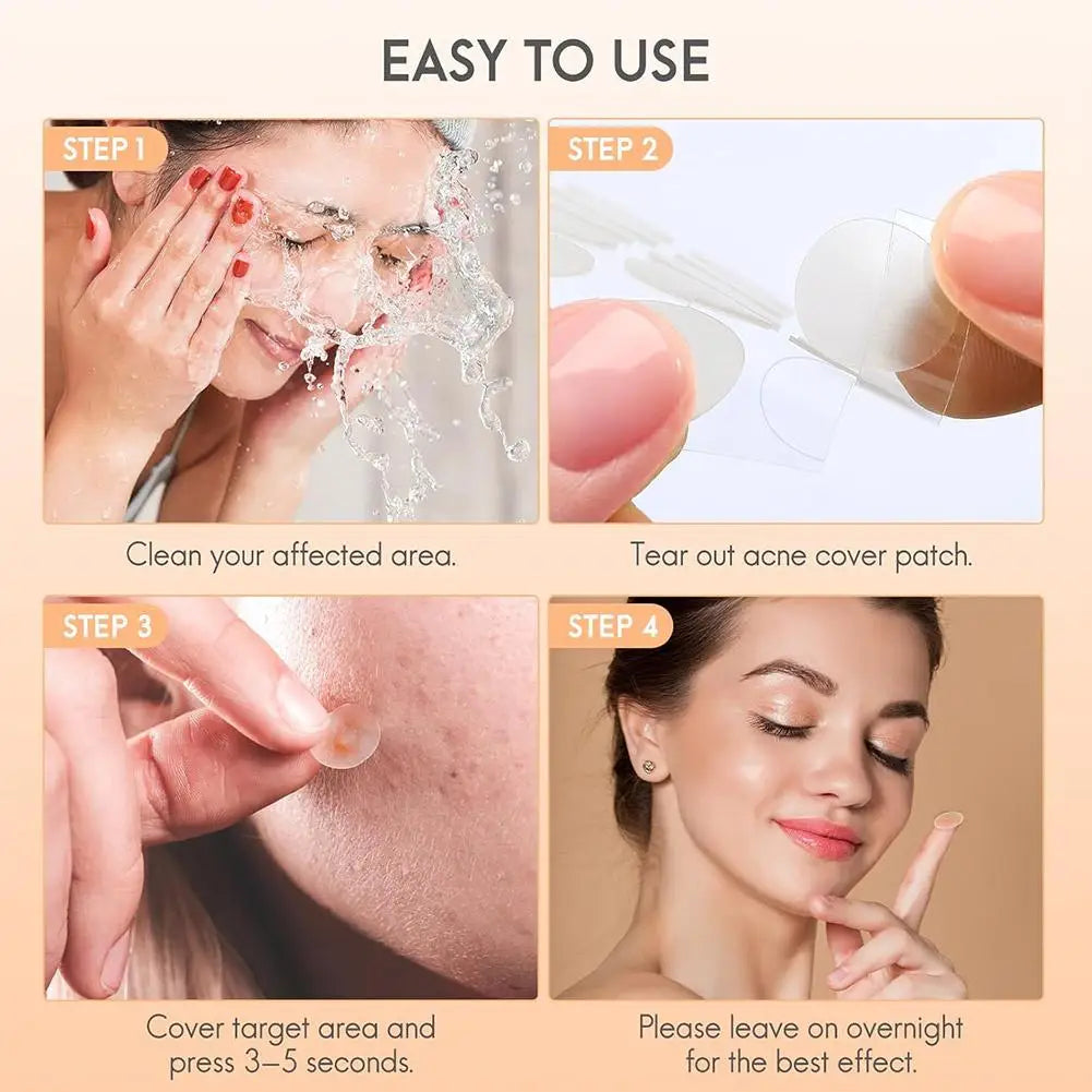 Large-Capacity Pimple Patch Set — Multi-Size Hydrocolloid Value Pack