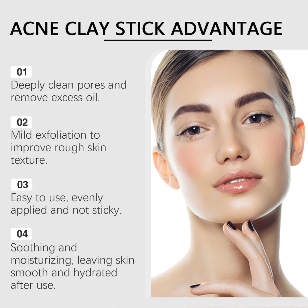 Pore Cleansing Clay Mask — Blackhead Removal & Sebum Control