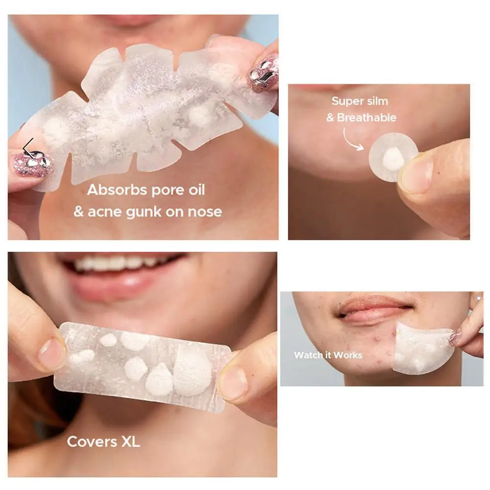 Large-Capacity Pimple Patch Set — Multi-Size Hydrocolloid Value Pack