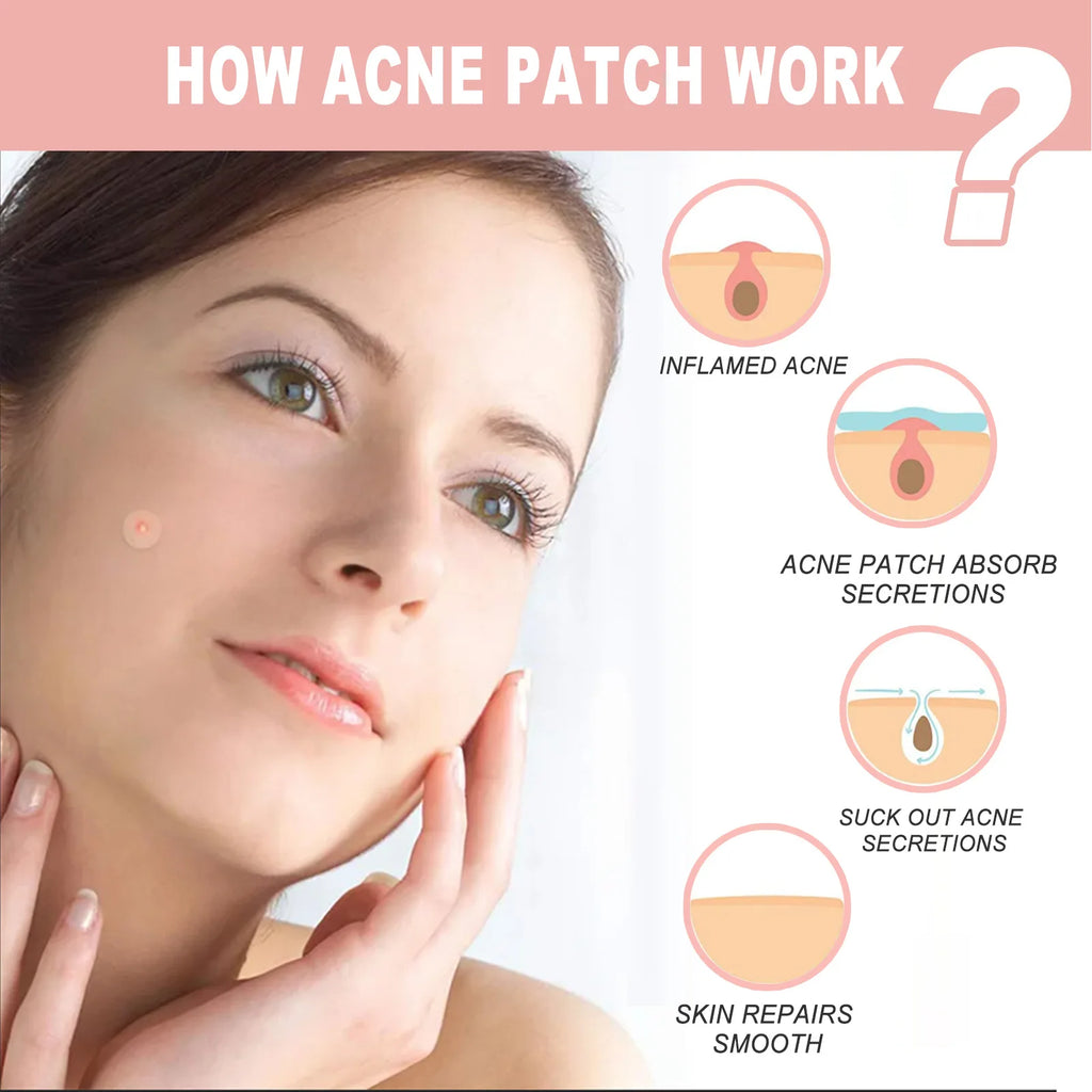 Hydrocolloid Face Patches for Pimples — Targeted Blemish Treatment