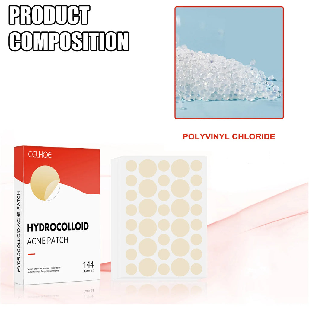 Hydrocolloid Acne Patches — 144 Pack, Ultra-Thin Overnight Treatment